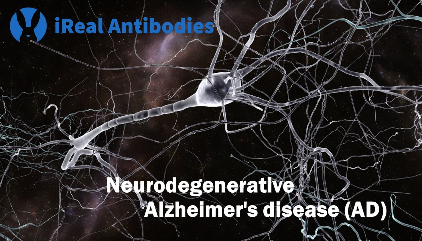 Neurodegenerative Alzheimer's disease (AD)