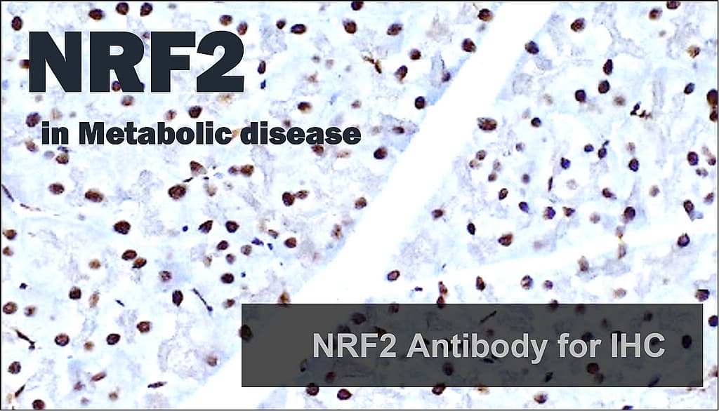 A Well-Clinical IHC Nrf2 Antibody for Cellular Redox Research