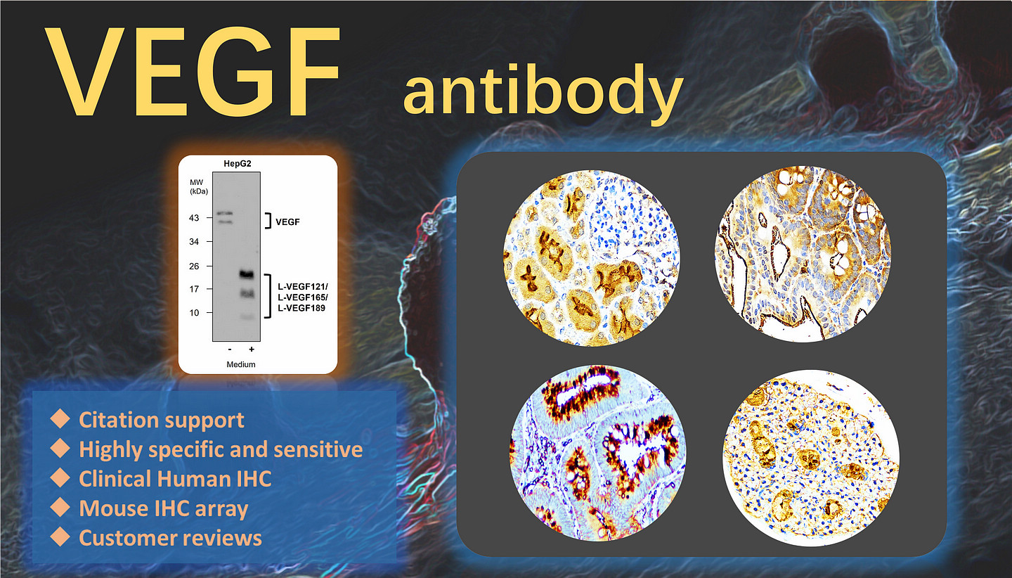 VEGF antibody  (IR108-442)