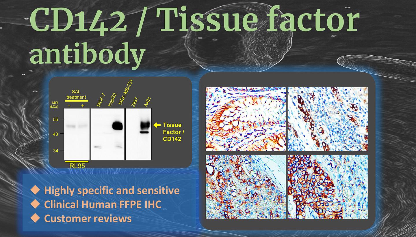 CD142 / Tissue factor Ab  (IR295-1)