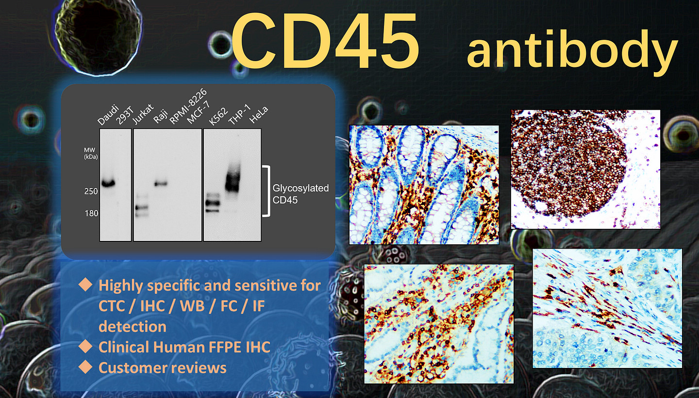 CD45 antibody  (IR77-264)