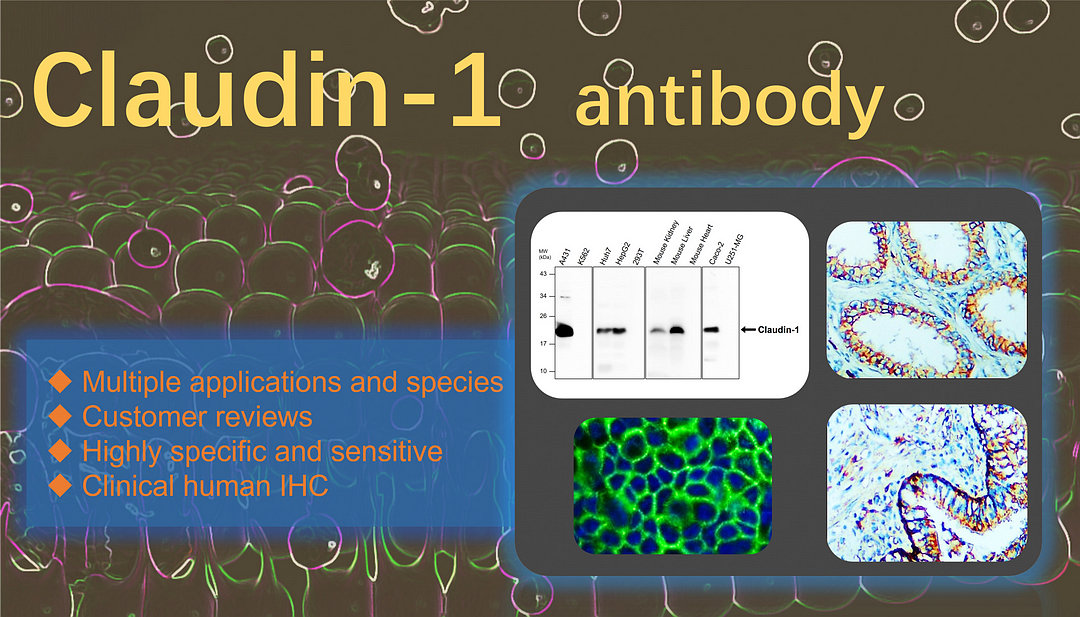 Claudin-1 antibody  (IR64-190)