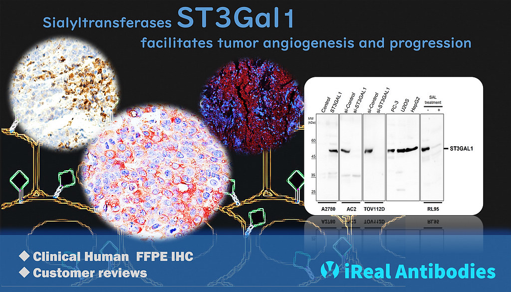 Sialyltransferases ST3Gal1 facilitates angiogenesis
