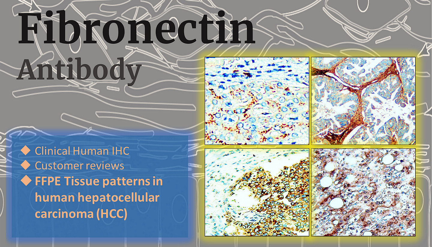 Fibronectin antibody  (IR48-138)