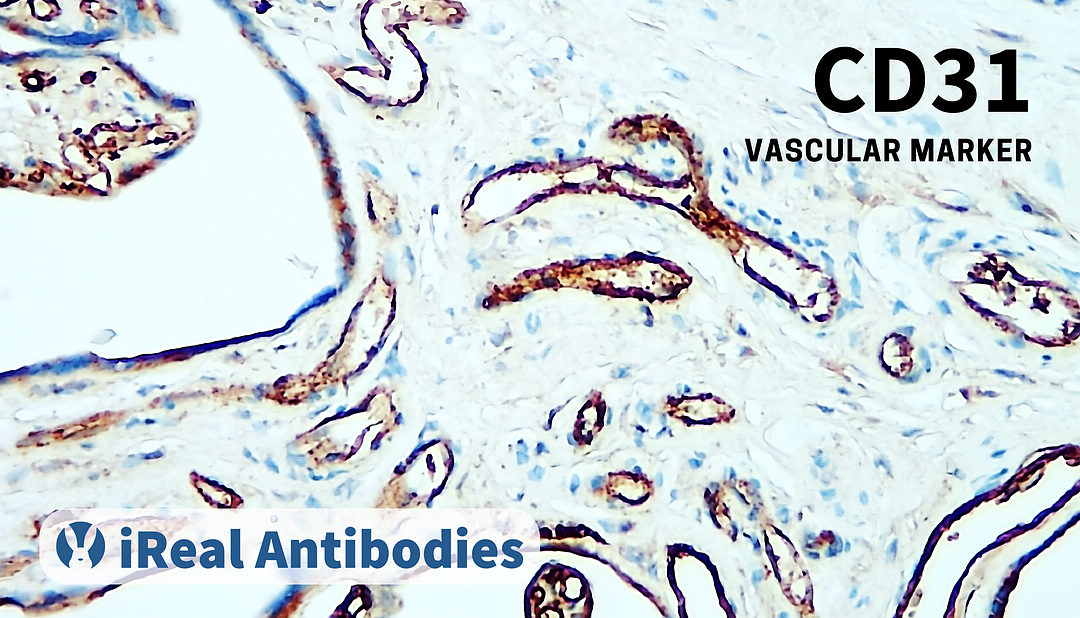 CD31 as a marker for endothelial cells