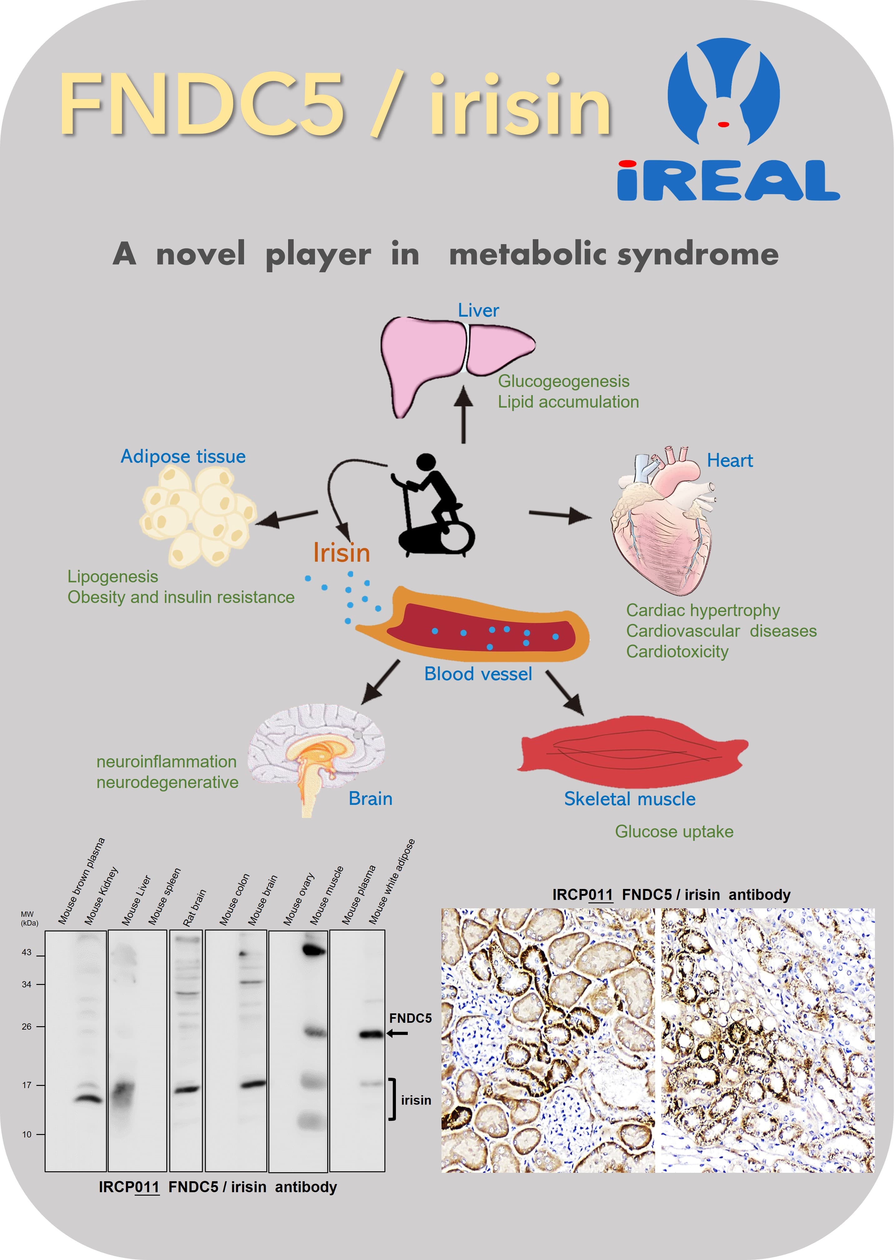 FNDC5 / irisin : a novel player in metabolic syndrome ( IRCP011 FNDC5 / irisin antibody )