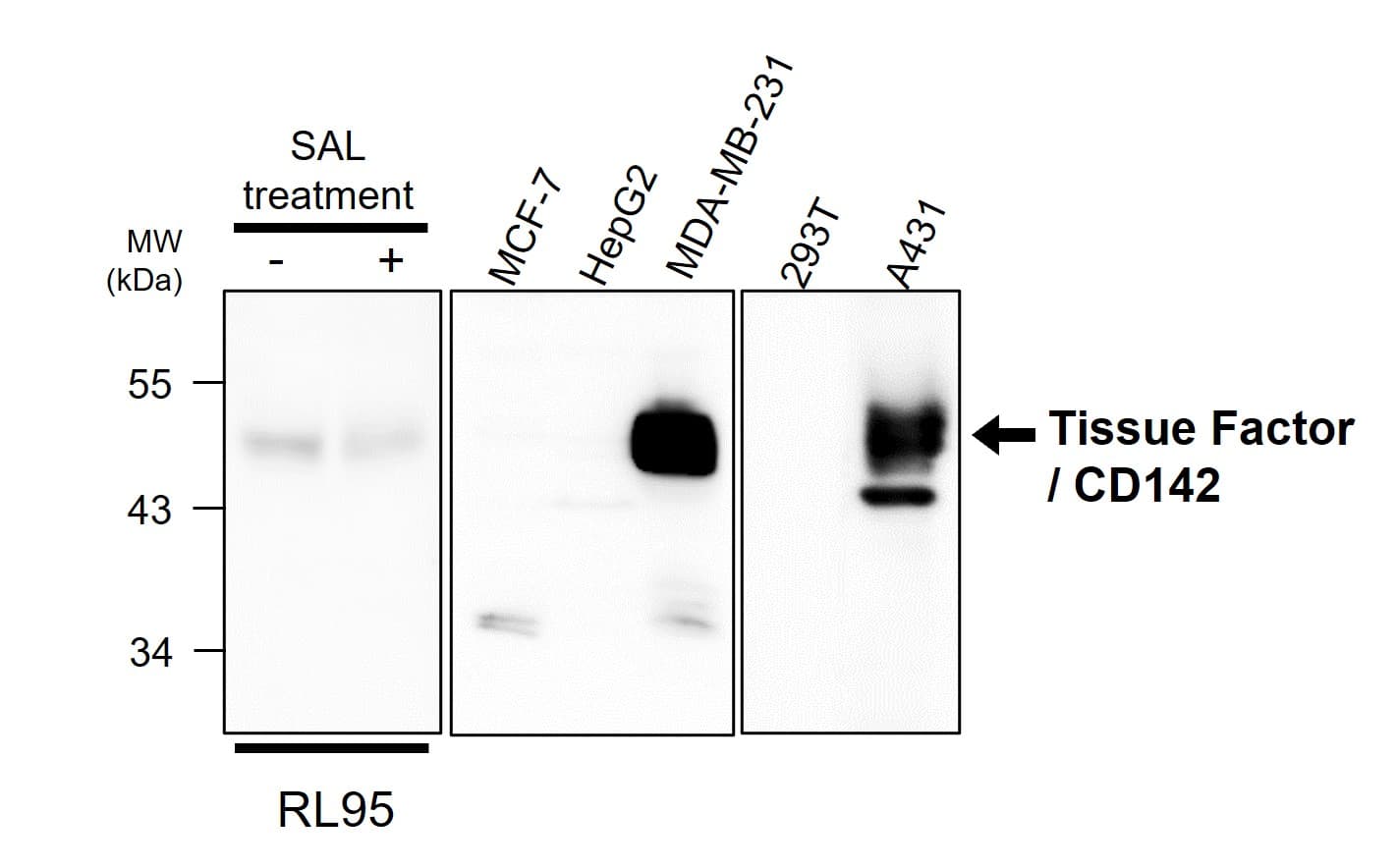 R295-1 anti-Tissue Factor / CD142 antibody WB image