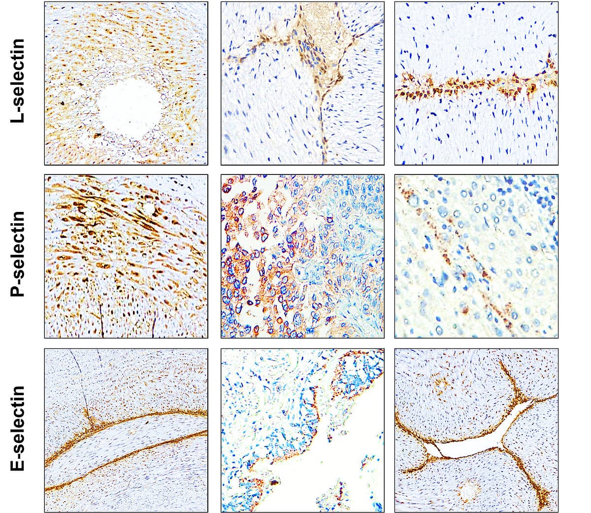 iReal’s GLOD CLASS antibodies for Selectin IHC experimental L-selectin P-selectin E-selectin
