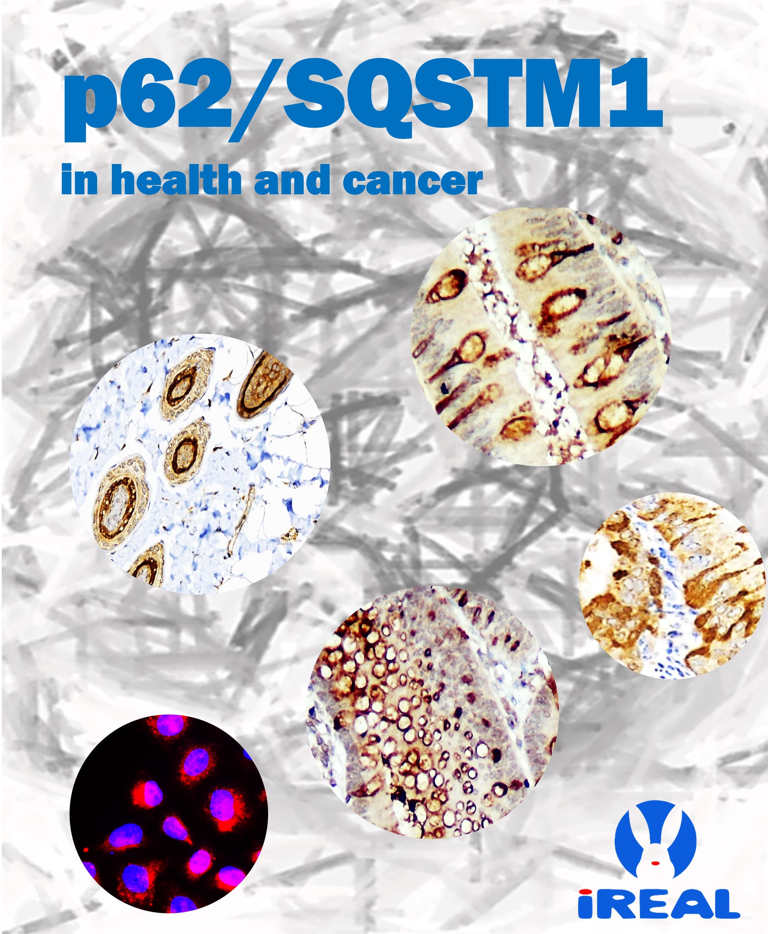 p62SQSTM1 in health and cancer antibodies IHC