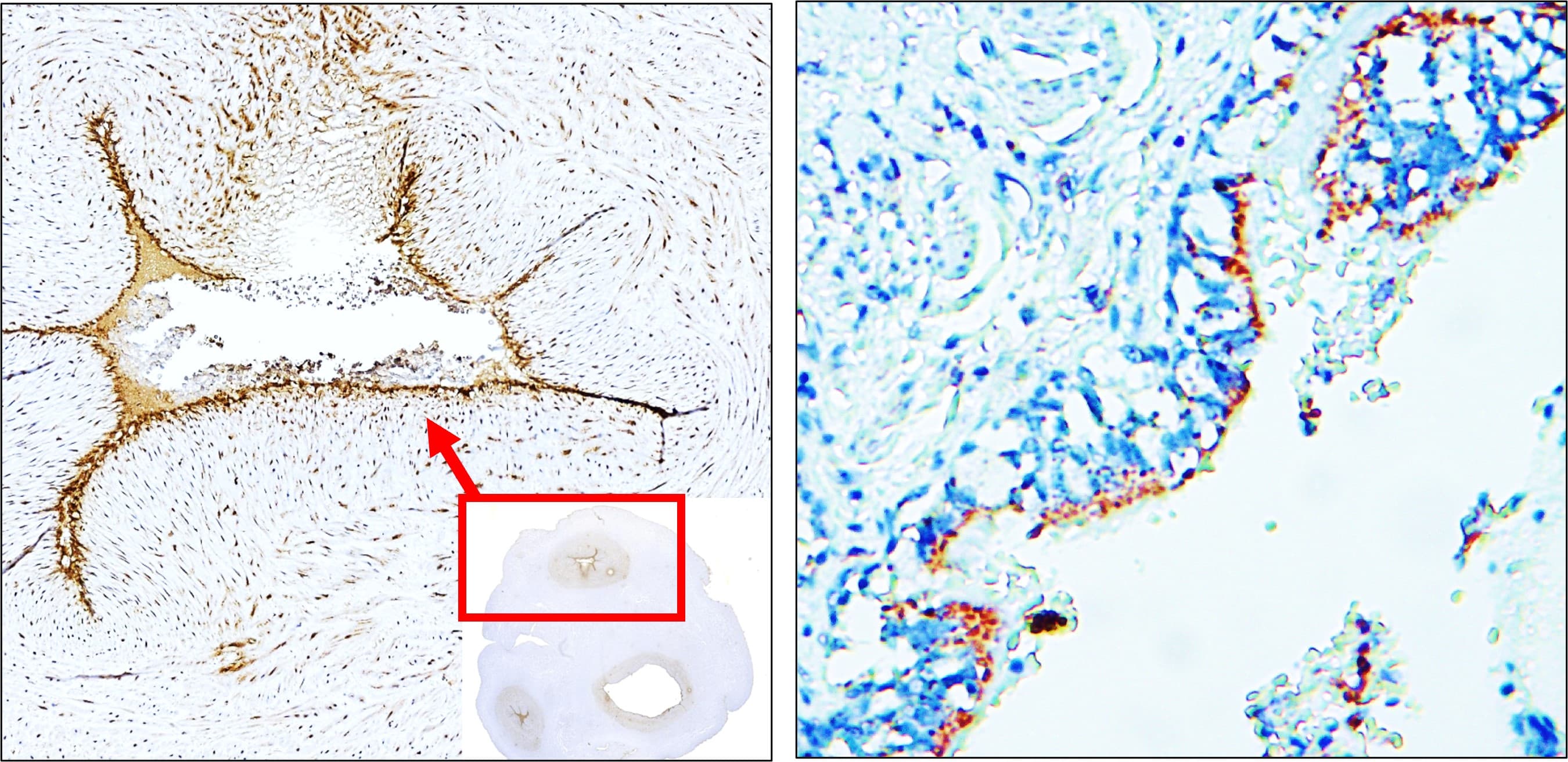 IR308-917 anti E-selectin / CD62E antibody IHC image