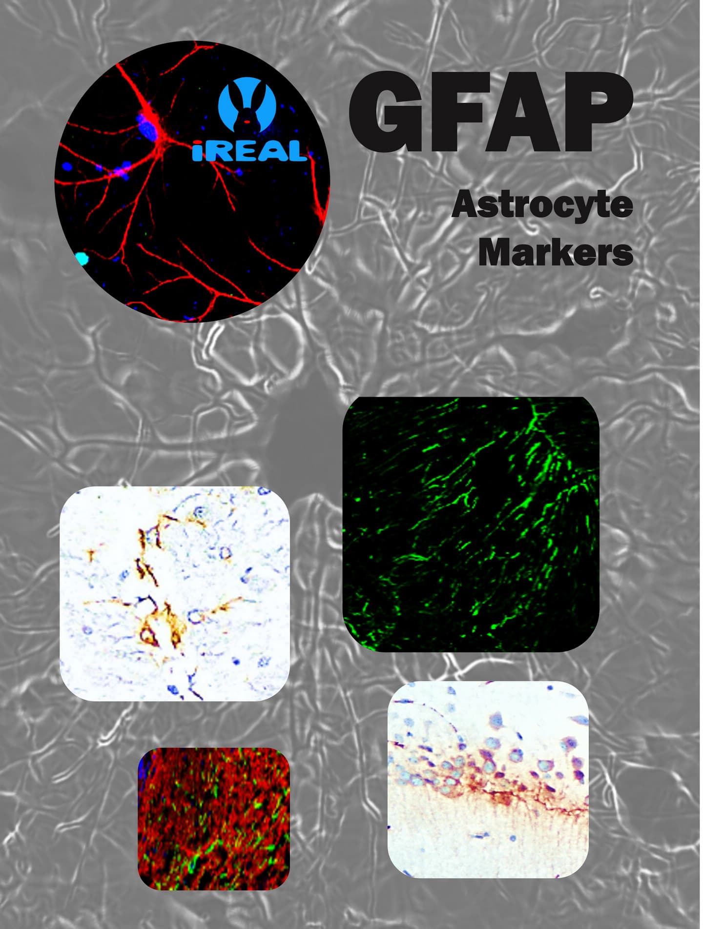 GFAP ( Astrocyte Markers ) IR15-44 GFAP antibody IHC IF