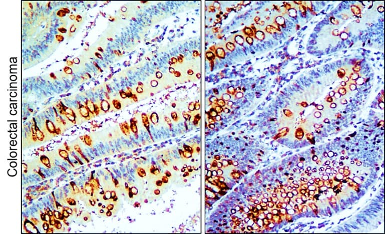 IR91-384 anti-SQSTM1 / p62 antibody IHC image