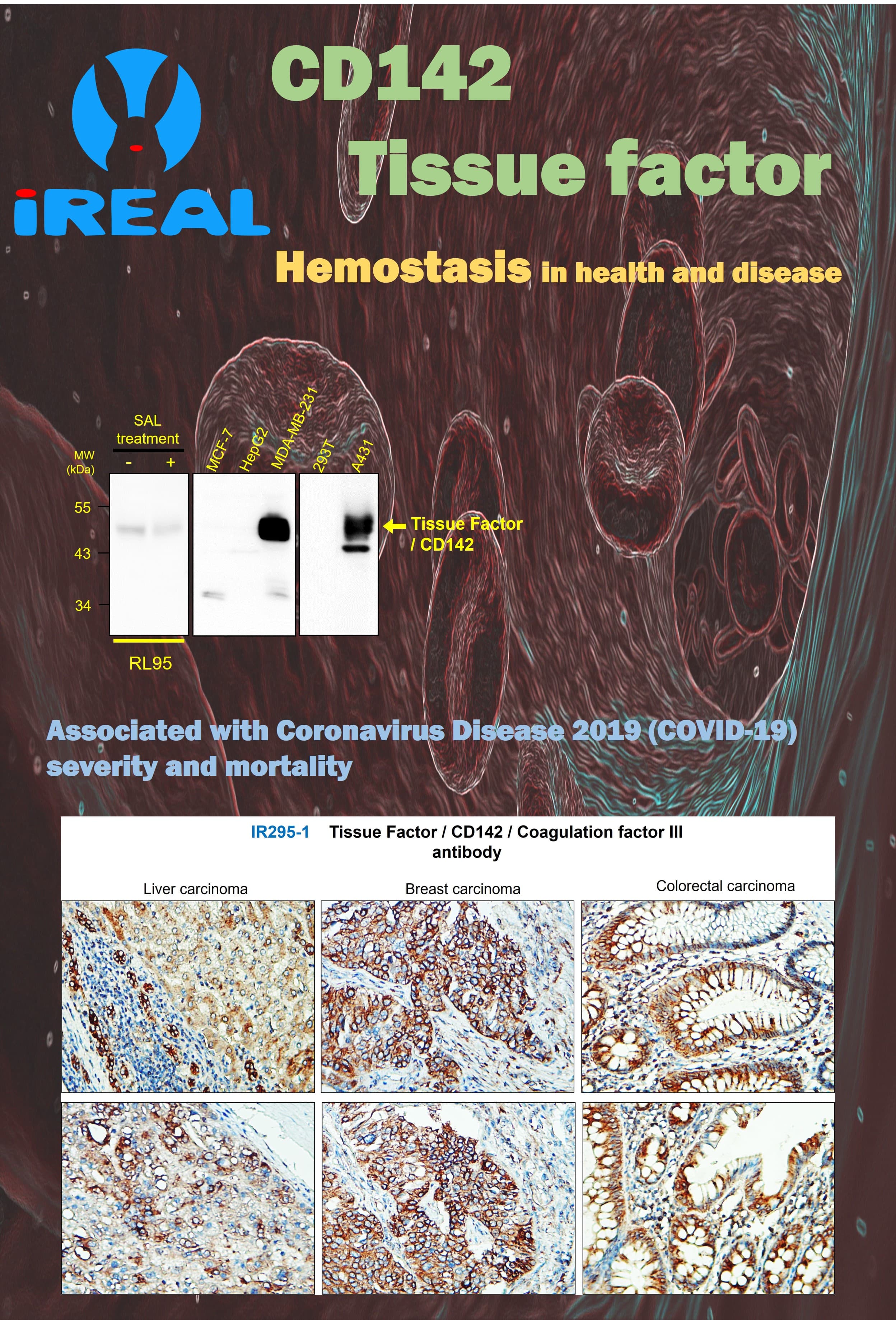 CD142, coagulation factor III, tissue factor, F3 Hemostasis in health and disease IHC WB