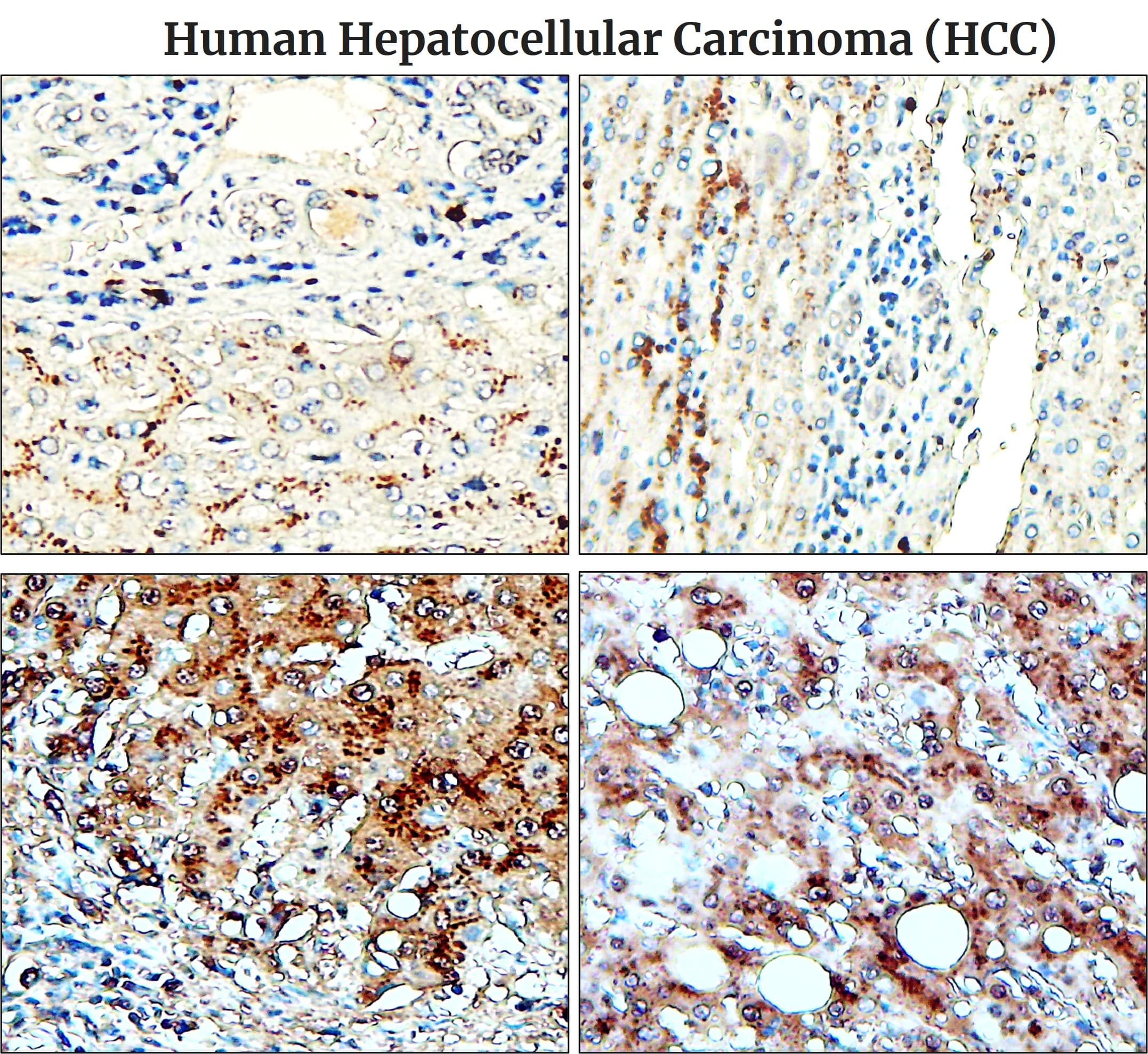 IR48-138 anti-Fibronectin antibody IHC image