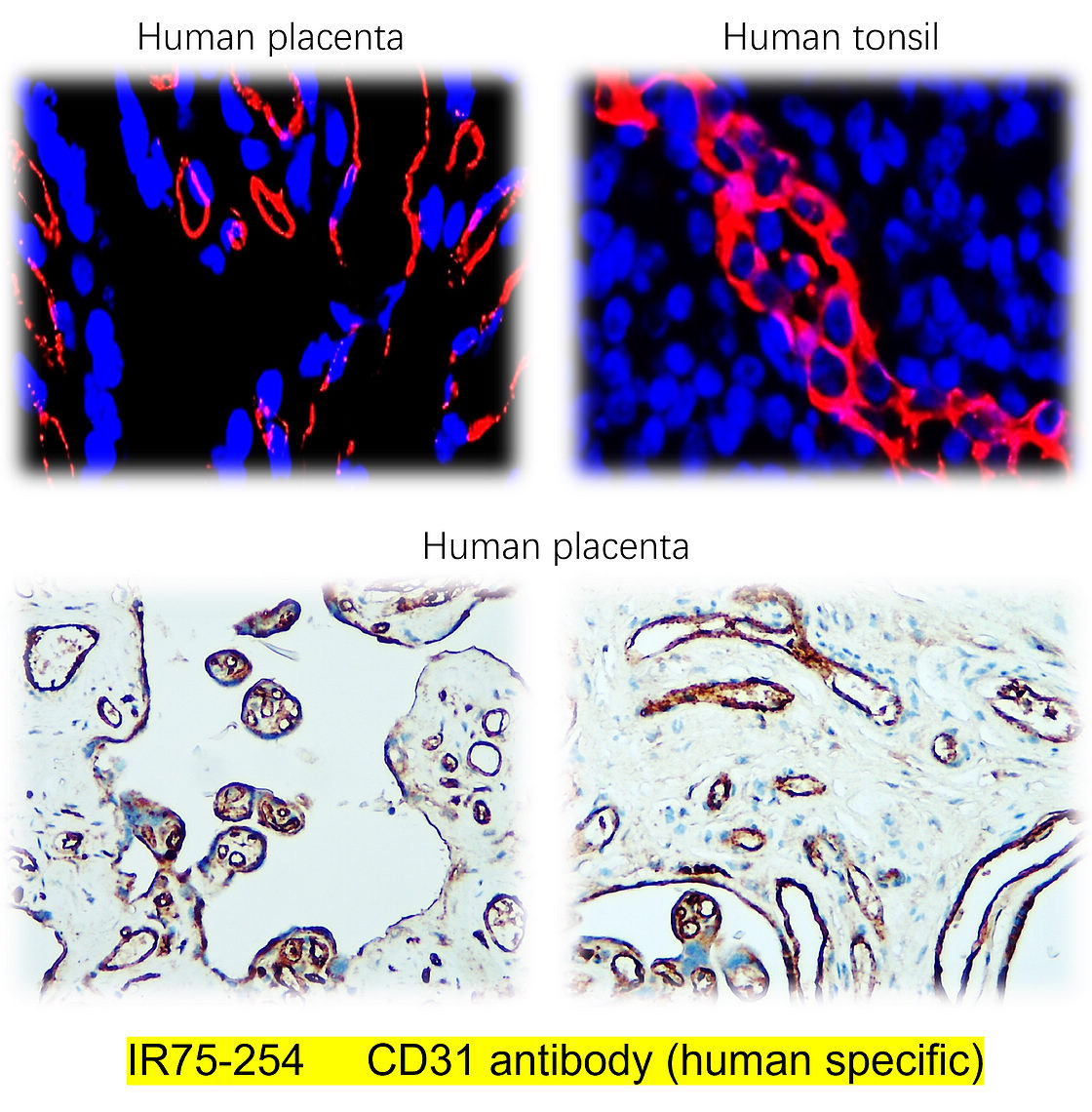 IR75-254_CD31 antibody (human specific) IHC image