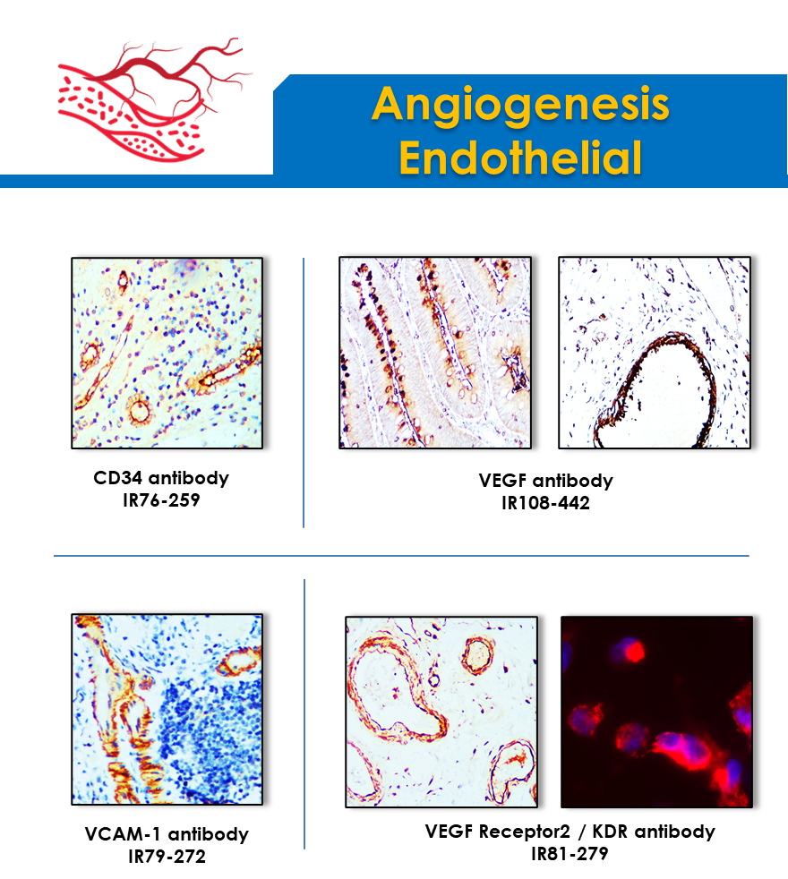 Irealbio Angiogenesis Endothelial antibodies
