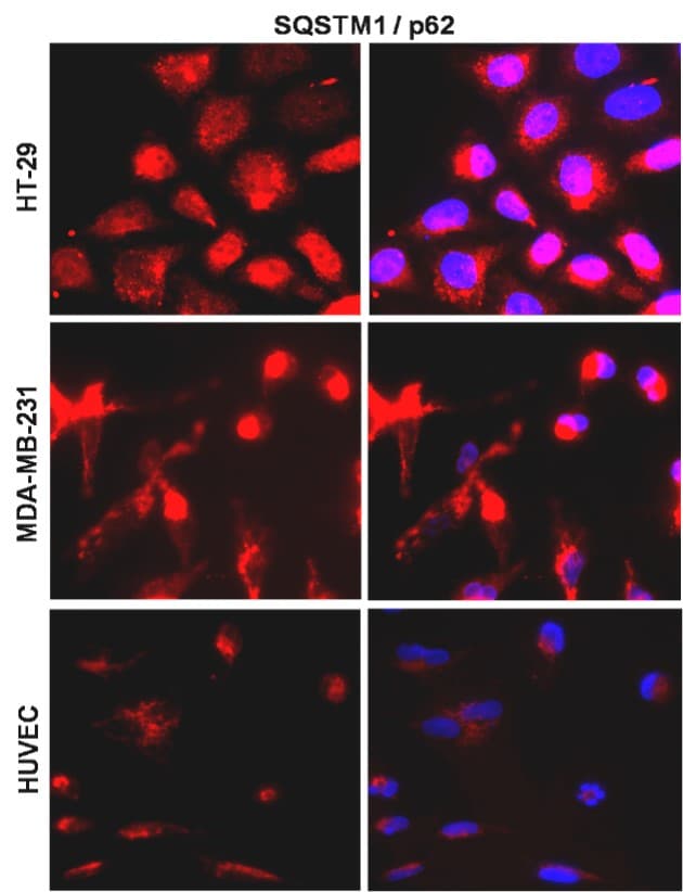 R91-384 anti-SQSTM1 / p62 antibody  ICC/ IF image