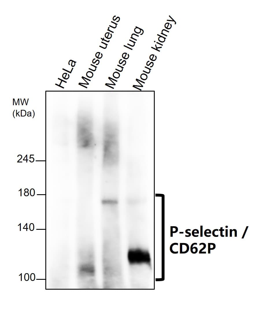 IR307-912 anti P-selectin / CD62P antibody WB image