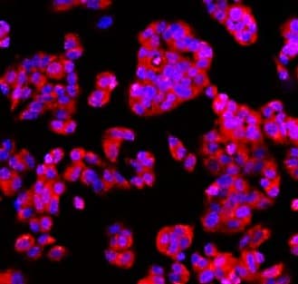 IR218-3 anti- EpCAM antibody ICC/IF image