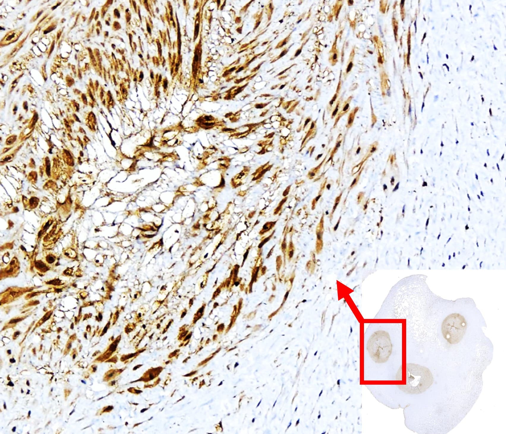 IR307-912 anti P-selectin / CD62P antibody IHC image