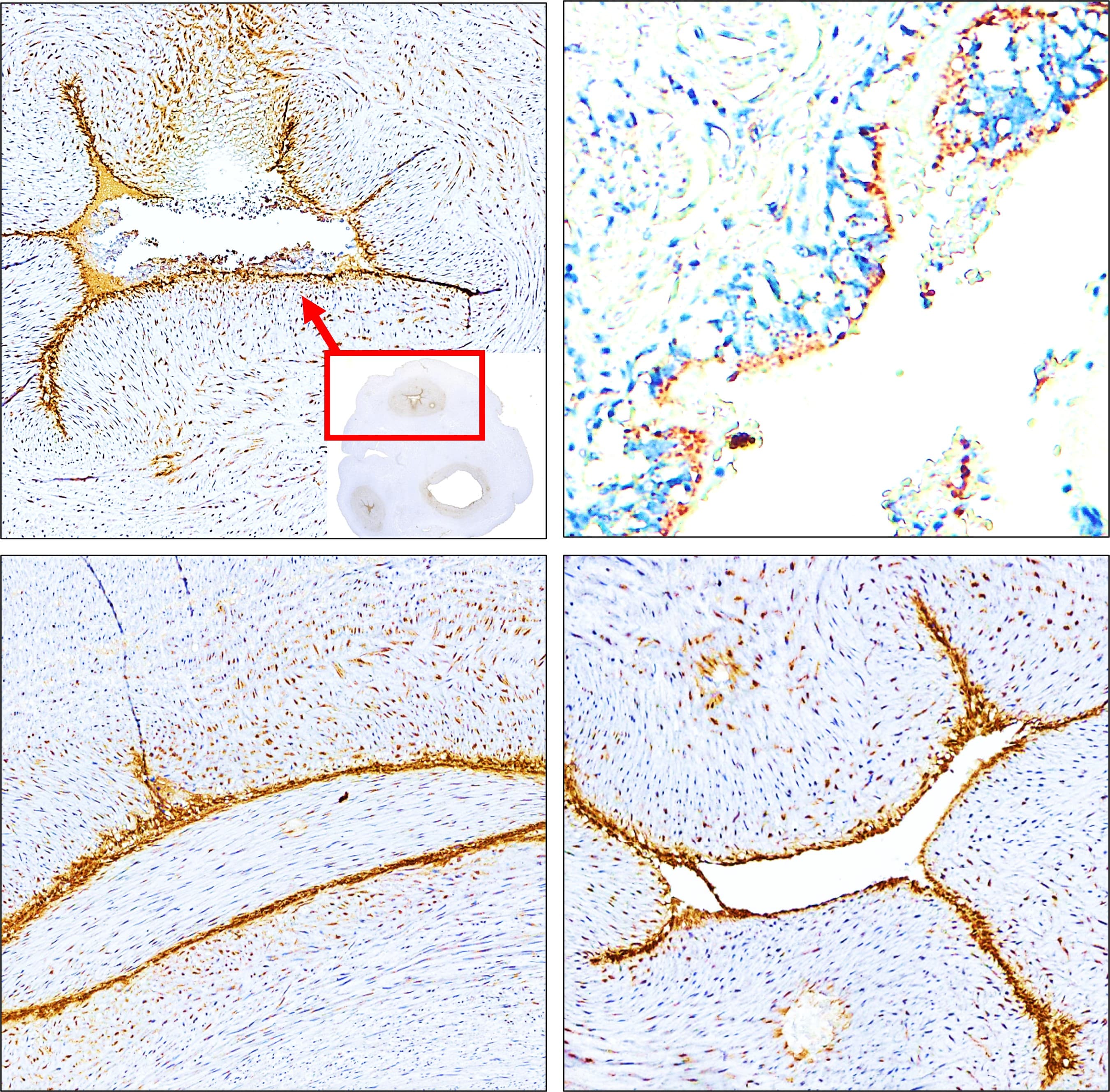 E-selectin / CD62E antibody IR308-917 IHC image