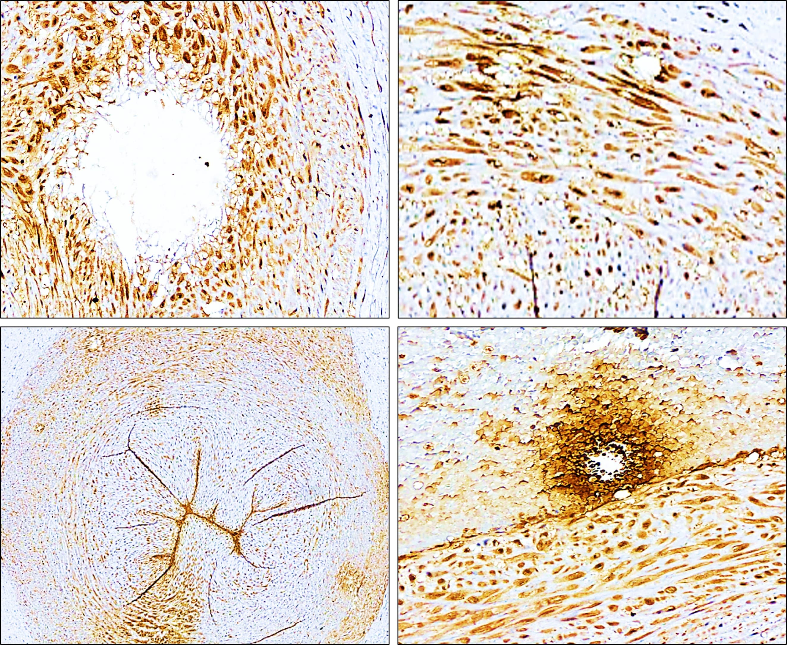 P-selectin / CD62P antibody IR307-912 IHC image