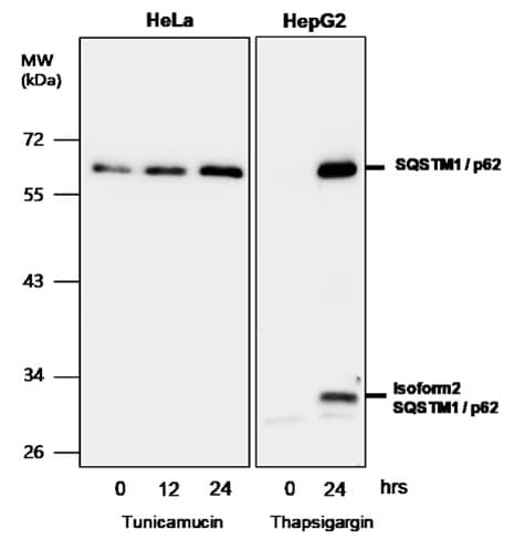IR91-384 anti-SQSTM1 / p62 antibody westerng