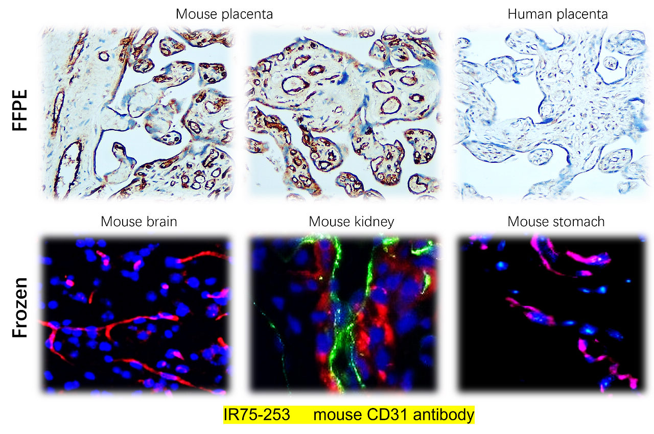 IR75-253_mouse CD31 antibody IHC image