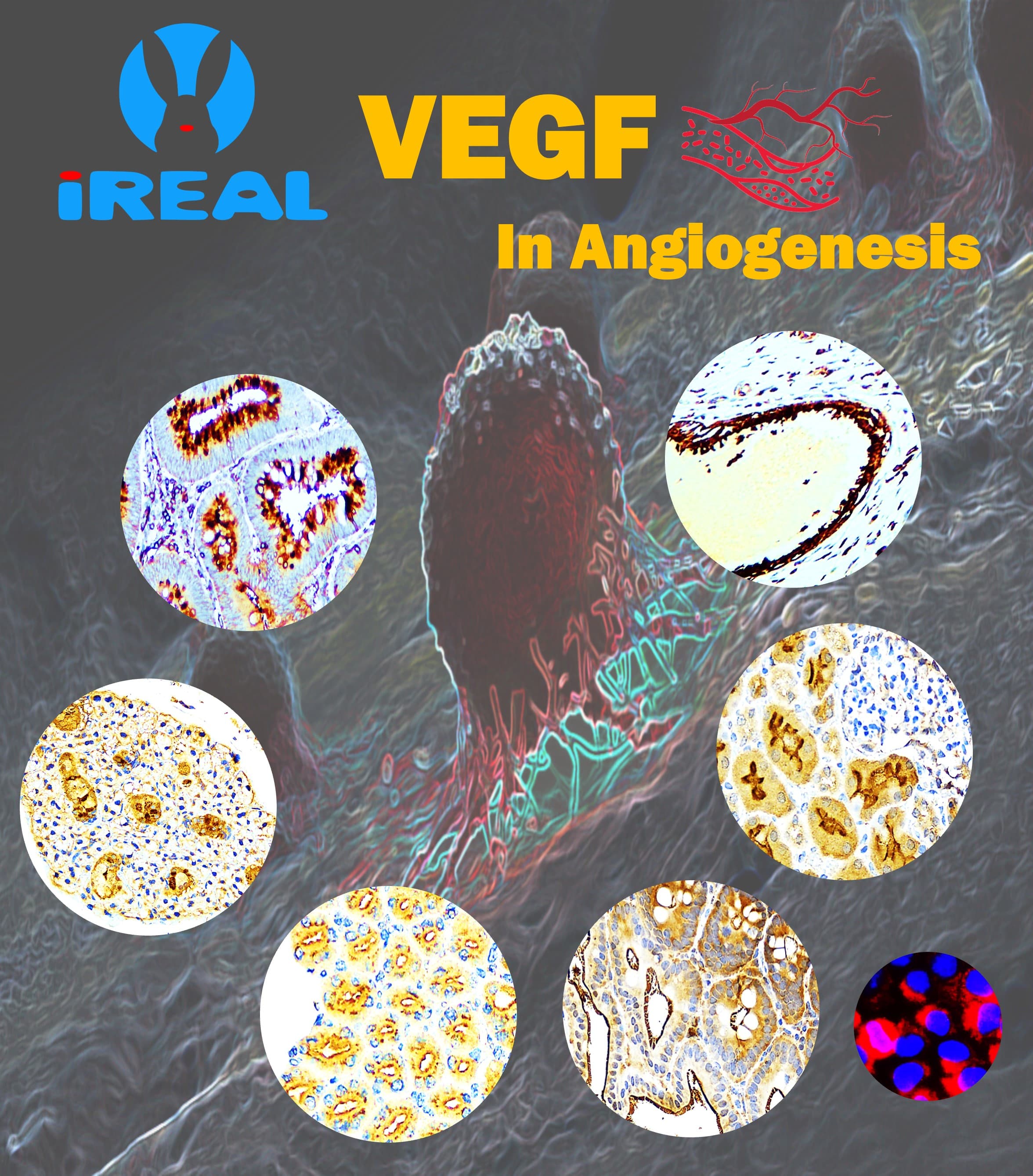 IR297-2 ST3GAL1 antibody : Sialylation in Cancer Invasion