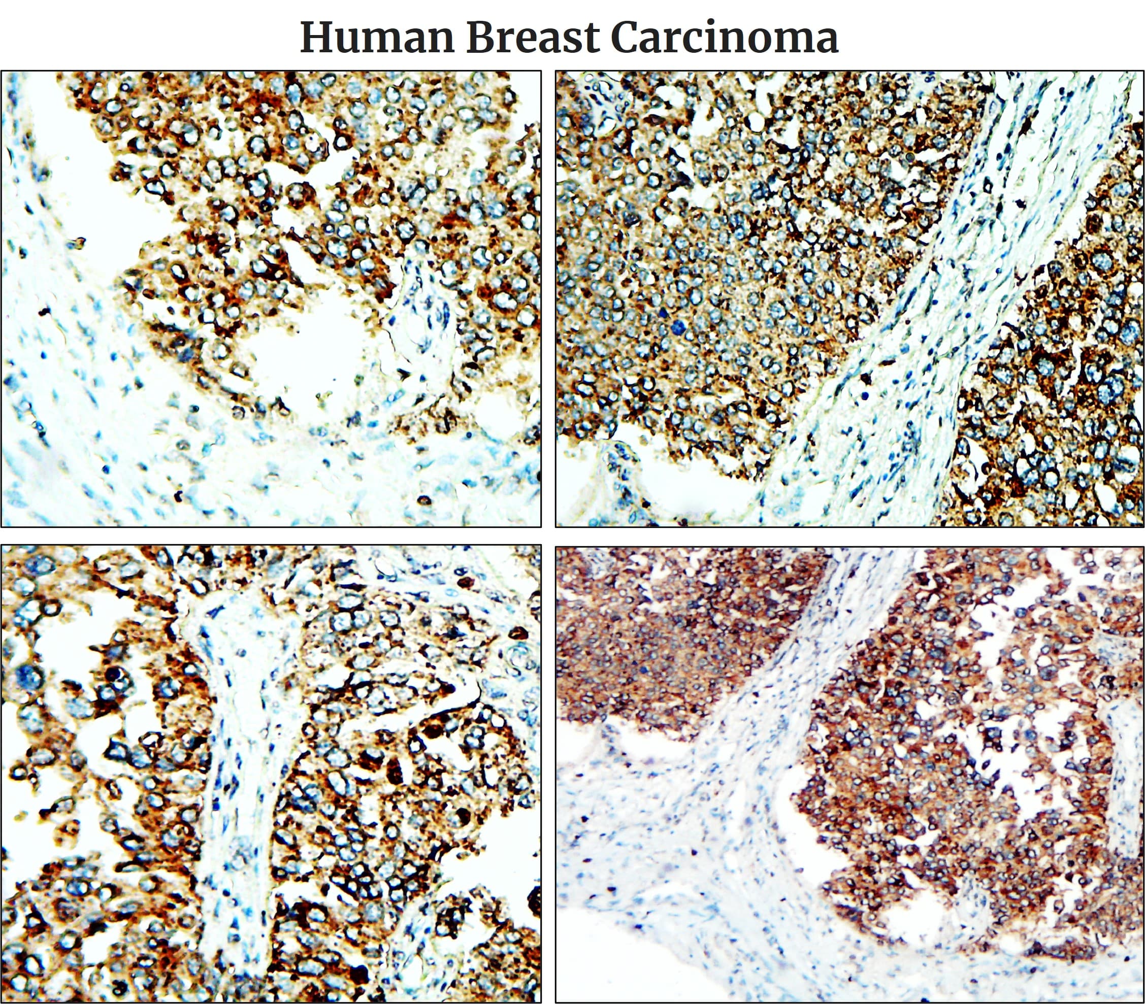 IR48-138 anti-Fibronectin antibody IHC image