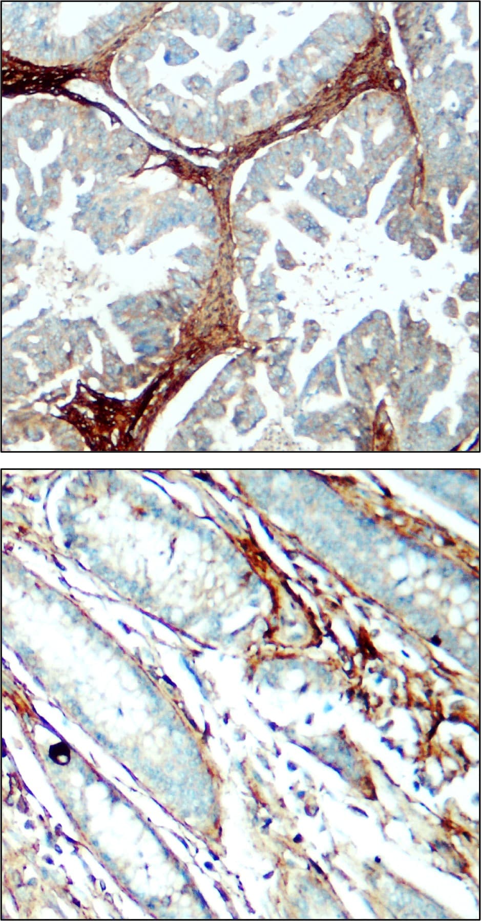 IR48-138 anti-Fibronectin antibody IHC image