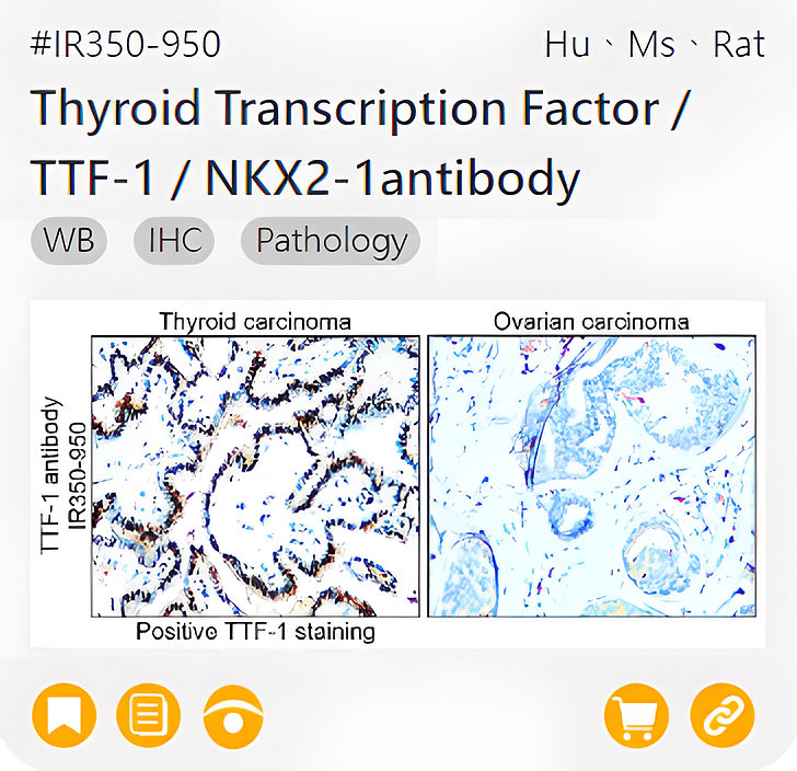 Oncology Biomarkers related product IR350-950_Thyroid Transcription Factor / TTF-1 / NKX2-1antibody page link