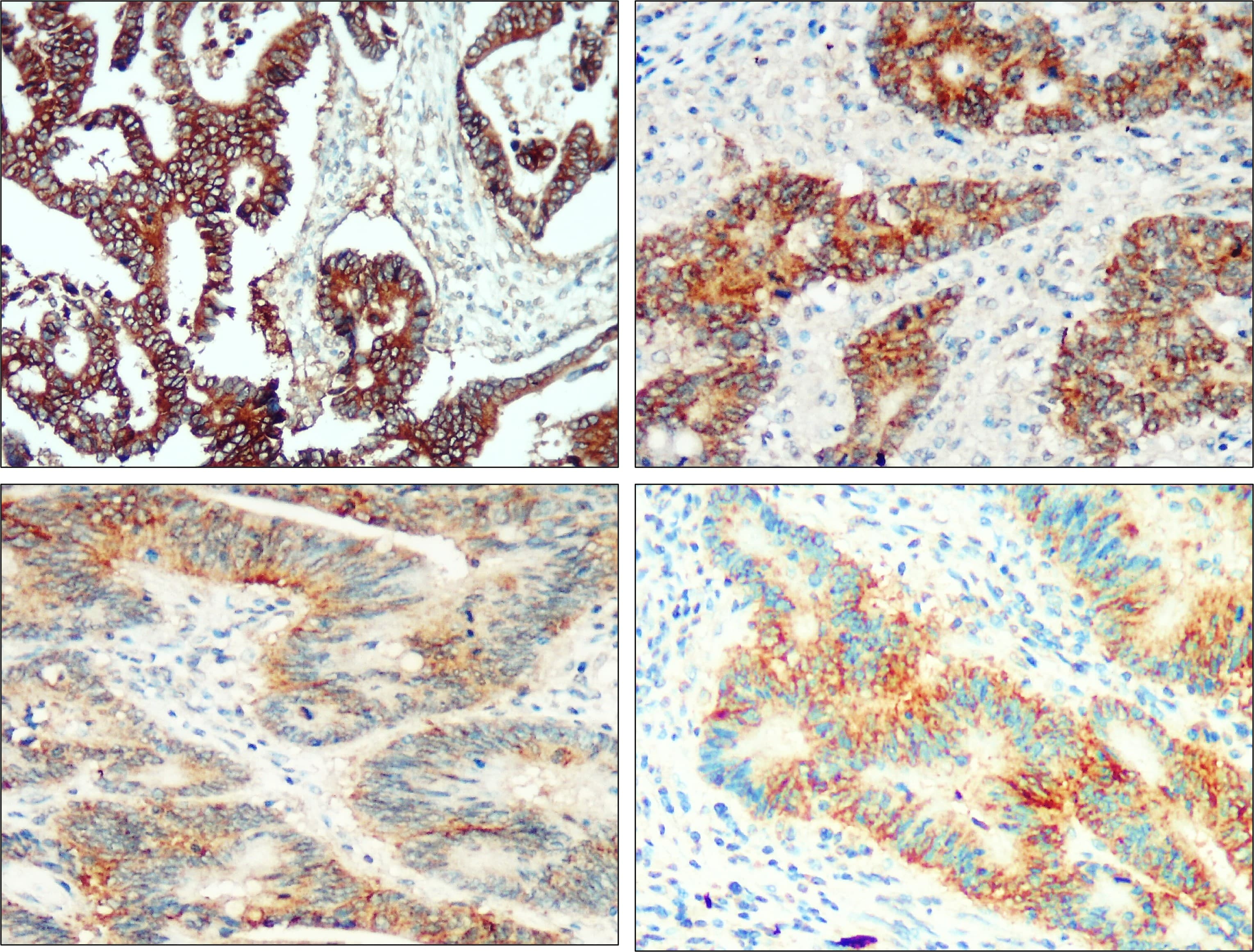IR218-3 anti- EpCAM antibody IHC image