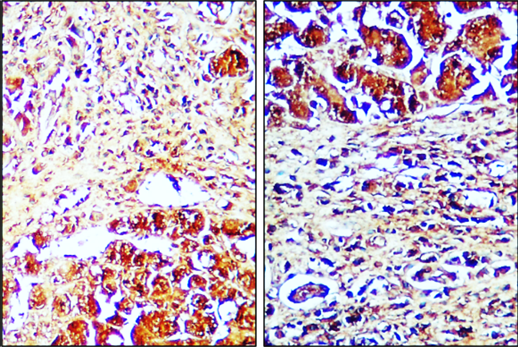 IR99-409 anti-Caspase8 antibody IHC image IR99-409 anti-Caspase8 antibody IHC image