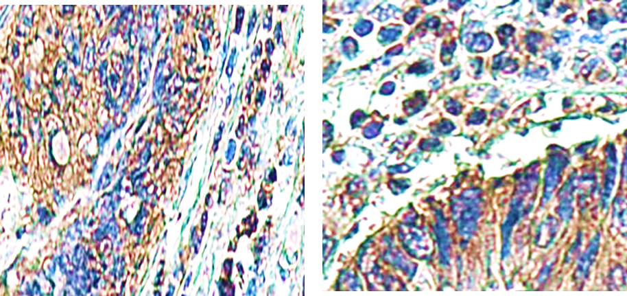 IR99-409 anti-Caspase 8 antibody IHC image 