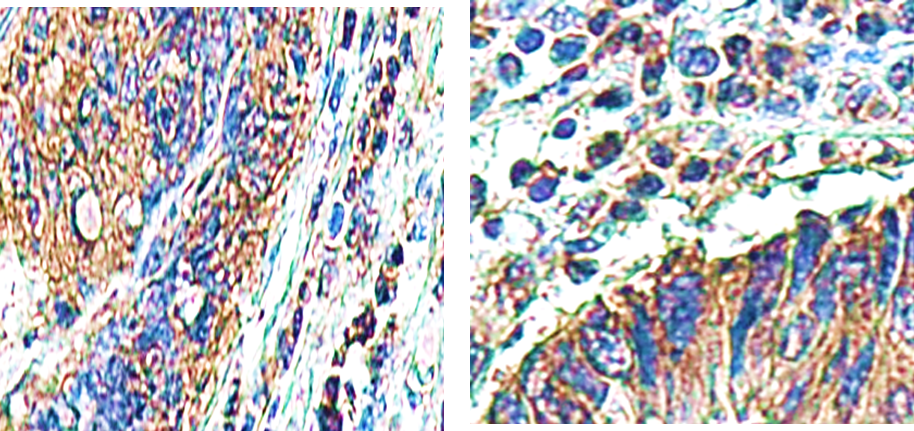 IR99-409 anti-Caspase 8 antibody IHC image IR99-409 anti-Caspase 8 antibody IHC image