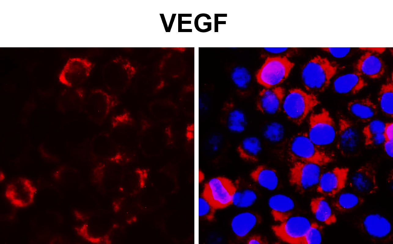 IR108-442 anti-VEGF antibody ICC/IF image