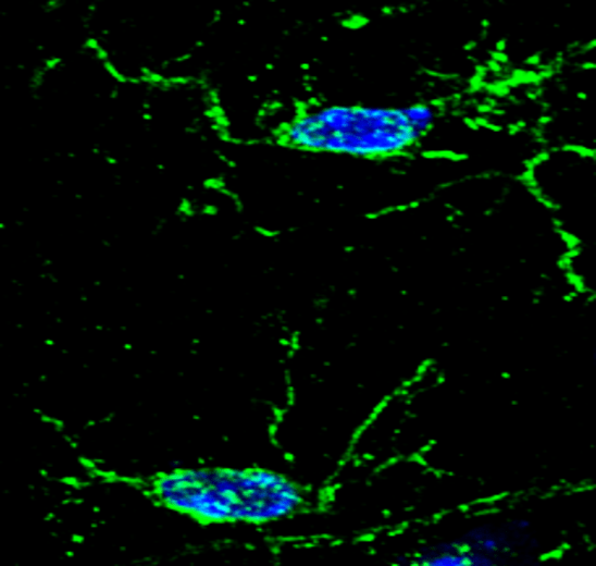 Customer feedback Image IR13-36 anti-Iba1/AIF1 antibody IHC-Fr image