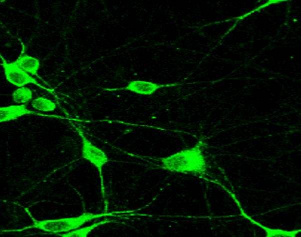 IR21-57 anti-NF-H antibody IF image IR21-57 anti-NF-H antibody IF image