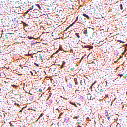 IR21-57 anti-NF-H antibody IHC image IR21-57 anti-NF-H antibody IHC image