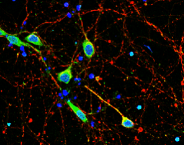 IR23-P1 anti- Neurofilament-L / NF-L antibody IF image