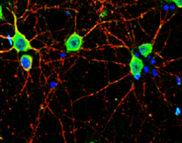 IR23-P2 anti- Neurofilament-L / NF-L antibody IF image IR23-P2 anti- Neurofilament-L / NF-L antibody IF image
