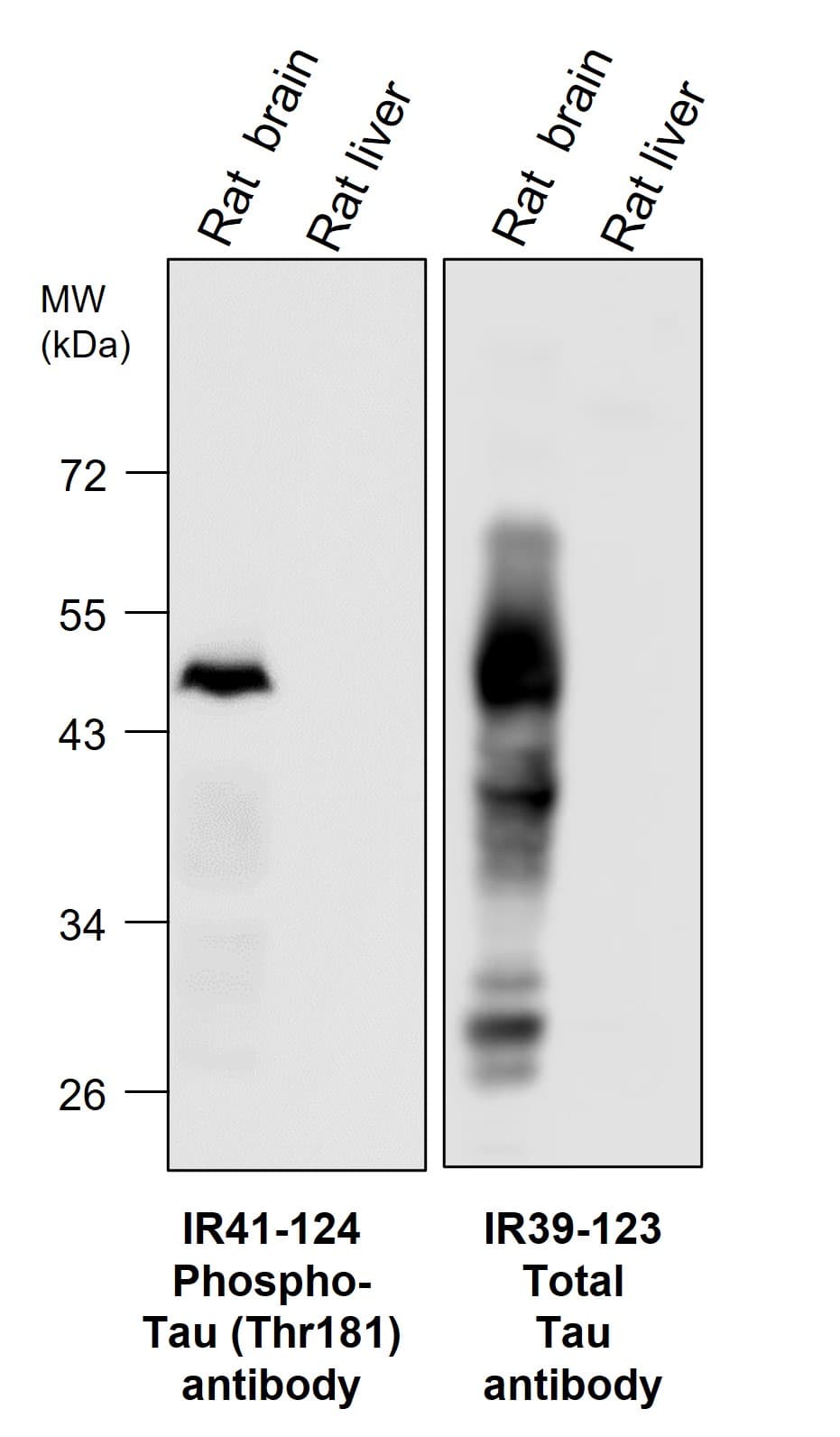 IR39-123 anti-Tau antibody WB image