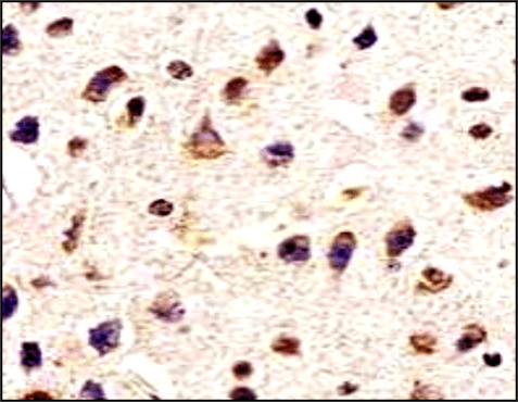 IR39-123 anti-Tau antibody IHC image