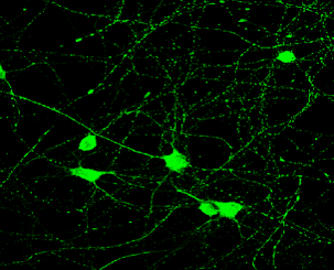 IR39-123 anti-Tau antibody IF image IR39-123 anti-Tau antibody IF image