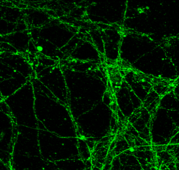 Customer feedback Image IR43-128 anti-alpha Synuclein antibody IF image