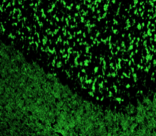Customer feedback Image IR43-128 anti-alpha Synuclein antibody IHC image Customer feedback Image IR43-128 anti-alpha Synuclein antibody IHC image