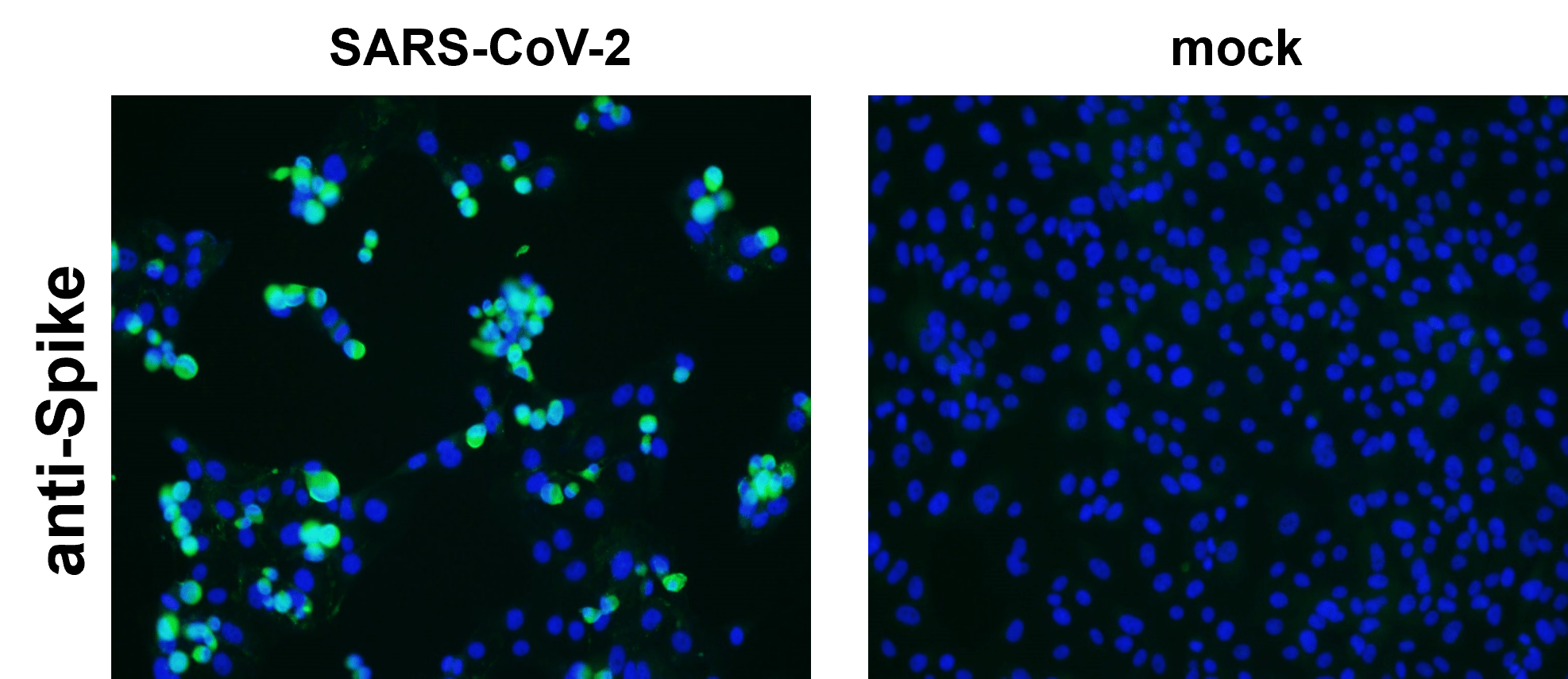 Customer feedback ICC/IF Image IRST003 anti-SARS-CoV-2 spike protein antibody Customer feedback ICC/IF Image IRST003 anti-SARS-CoV-2 spike protein antibody