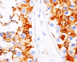 IR1-2-2 anti-Vinculin antibody IHC image IR1-2-2 anti-Vinculin antibody IHC image