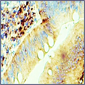 MMP9 antibody MMP9 antibody